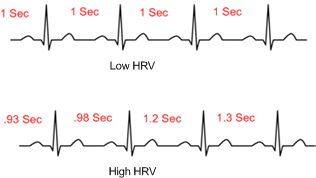 HRV ECG